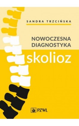 Nowoczesna diagnostyka skolioz - Sandra Trzcińska - Ebook - 978-83-200-6697-5