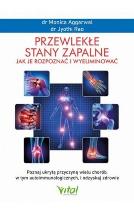 Przewlekłe stany zapalne. Jak je rozpoznać i wyeliminować - Monica Aggarwal - Ebook - 978-83-8272-182-9