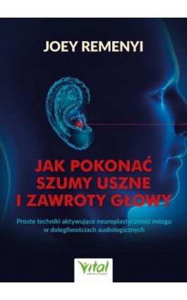 Jak pokonać szumy uszne i zawroty głowy - Joey Remenyi - Ebook - 978-83-8272-108-9