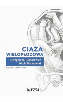 Ciąża wielopłodowa - Ebook - 978-83-01-22507-0