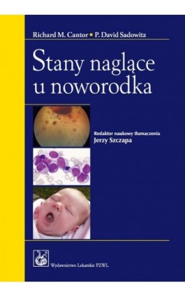 Stany naglące u noworodka - Ebook - 978-83-200-4144-6