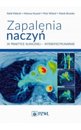 Zapalenia naczyń w praktyce klinicznej interdyscyplinarnie - Rafał Małecki - Ebook - 978-83-01-22549-0