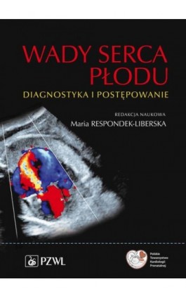 Wady serca płodu - Ebook - 978-83-01-22777-7