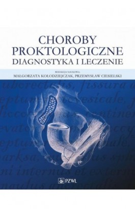 Choroby proktologiczne - Ebook - 978-83-01-22536-0