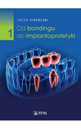 Od bondingu do implantoprotetyki Część 1 - Jacek Ciesielski - Ebook - 978-83-01-23038-8