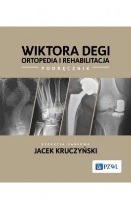 Wiktora Degi ortopedia i rehabilitacja - Ebook - 978-83-01-23260-3