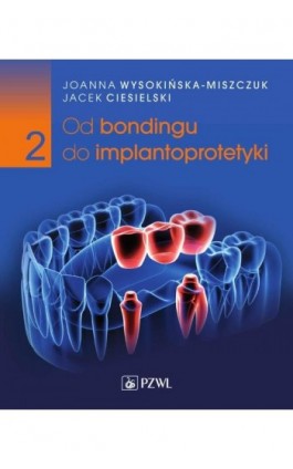 Od bondingu do implantoprotetyki Część 2 - Joanna Wysokińska-Miszczuk - Ebook - 978-83-01-23289-4