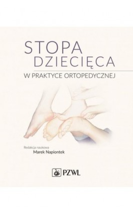 Stopa dziecięca w praktyce ortopedycznej - Ebook - 978-83-200-6511-4