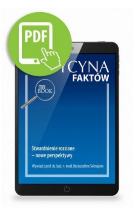 Stwardnienie rozsiane – nowe perspektywy [Medycyna Faktów 4/2021] - Krzysztof Selmaj - Ebook