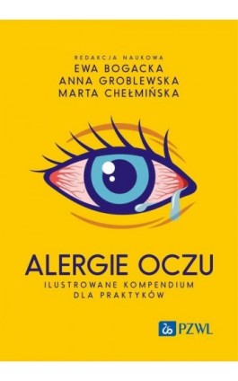 Alergie oczu. Ilustrowane kompendium dla praktyków - Ebook - 978-83-01-23385-3